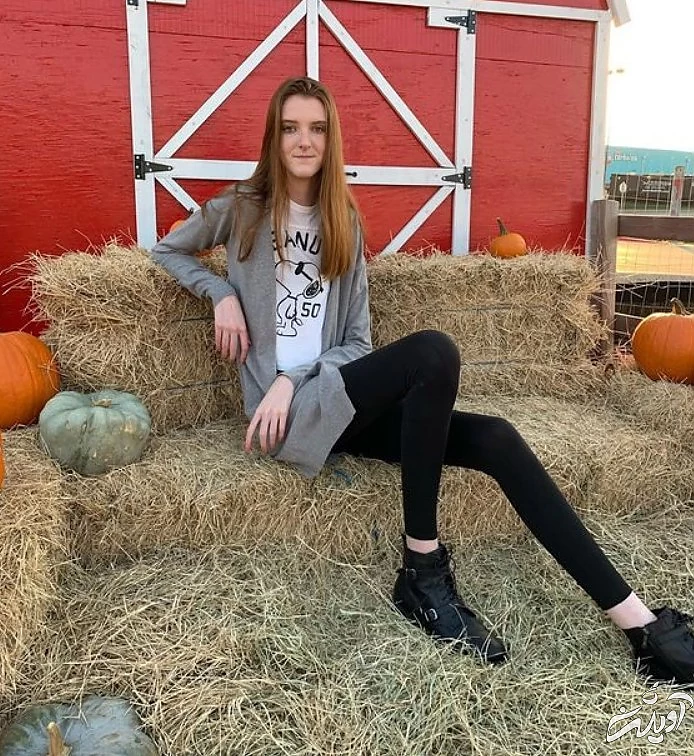 گرفتاری‌های دختری که صاحب بلندترین ساق‌های جهان است/ تصاویر